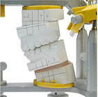 Modelloperation, kieferchirurgie planung