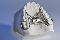 GNE, Hyrax, Gaumennahterweiterung