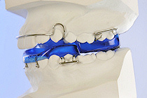 Twinblock, clark, doppelplatten