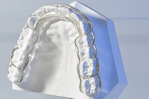 dohnerschiene, dohnersplint, retentionsschiene