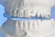 Michiganschiene, Knirscherschiene